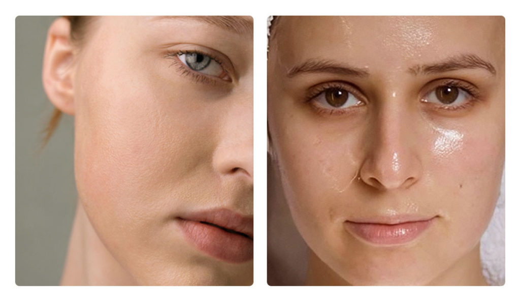 Routine Cho Da Khô Chuẩn Dược Mỹ Phẩm – Cấp Ẩm Sâu, Phục Hồi Hàng Rào Bảo Vệ Và Ngăn Lão Hóa Sớm