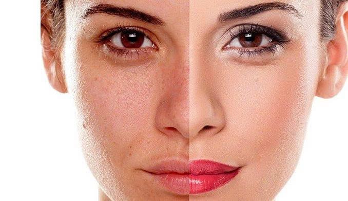 Stress & ảnh hưởng lên da: Vì sao da “xuống cấp” và cách phục hồi cùng cfr.vn