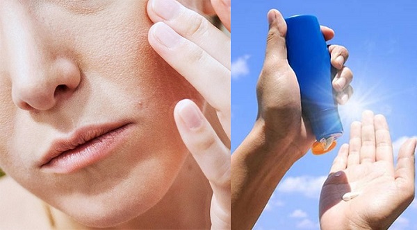 Chống nắng cho da nhạy cảm: Bảo vệ da an toàn 